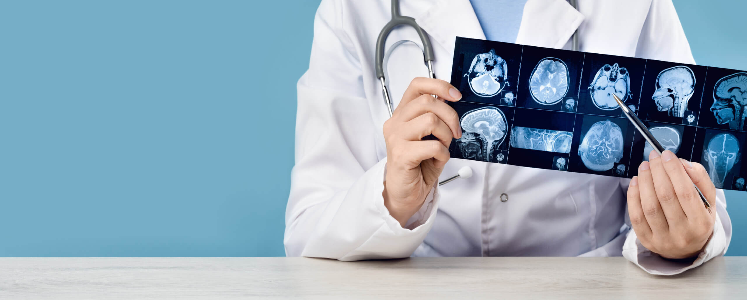 Doctor studying brain scans for patient with epilepsy.