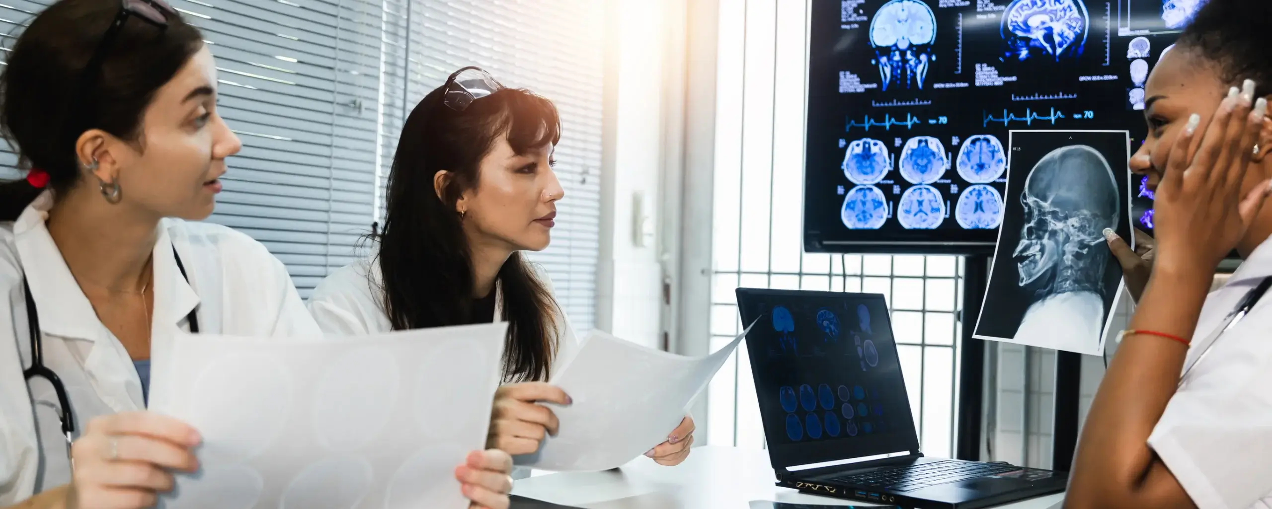 doctors discussing results of brain scans